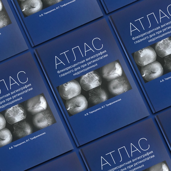 Сложности при переходе на аутсорсинг печати